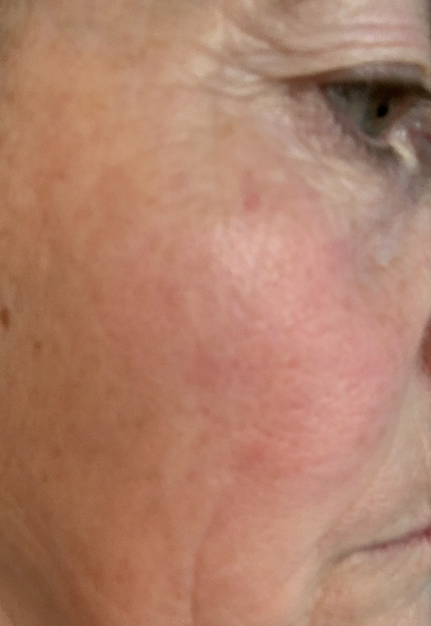 Before using the routine