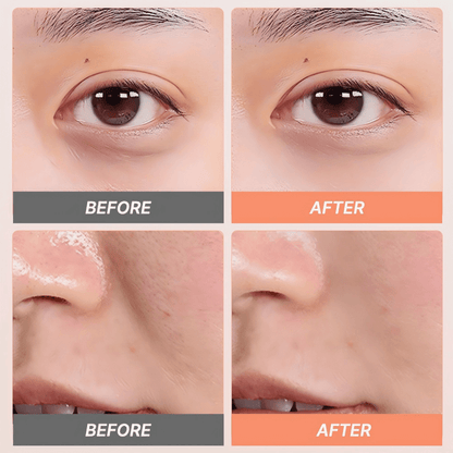 Lift2 Beauty Device – Multi - Dimensional Anti - Aging Technology - TOUCHBeauty