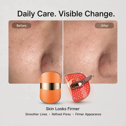 TOUCHBeauty™ GLAM LED Light Therapy Mask for Clearer, Brighter Skin - TOUCHBeauty