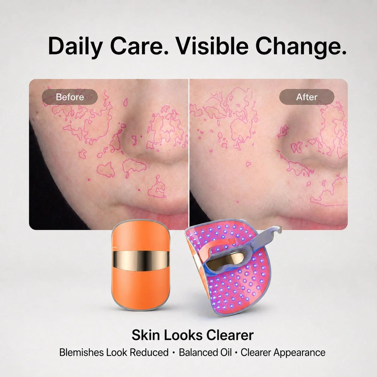 TOUCHBeauty™ GLAM LED Light Therapy Mask for Clearer, Brighter Skin - TOUCHBeauty