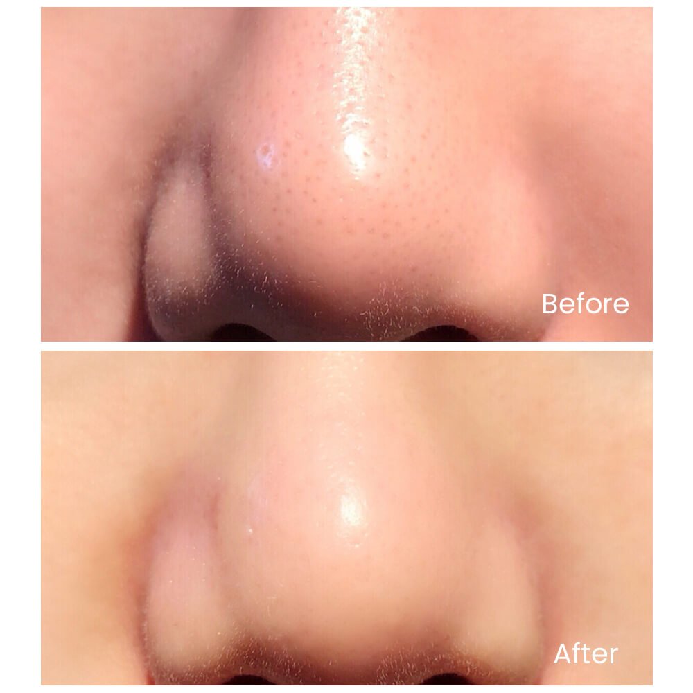 ULTRASONIC SCRUB DEVICE | TOUCHBeauty GLOW - TOUCHBeauty